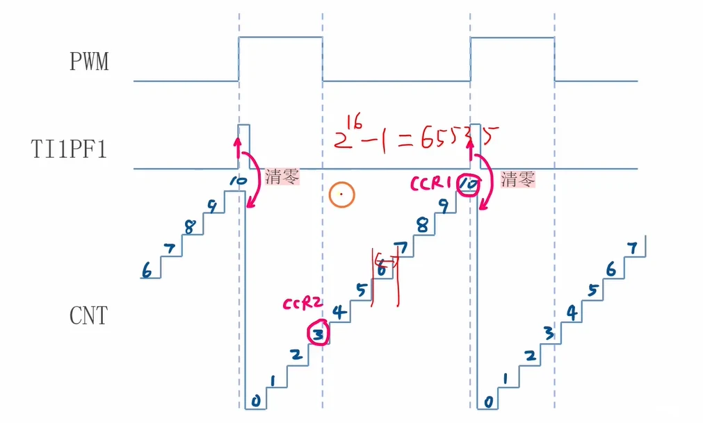 TIM1 时基配置：72MHz 时钟①、总开关④、PSC=71②（1μs 分辨率）、ARR=65535③（最大周期）、RCR=0 → update